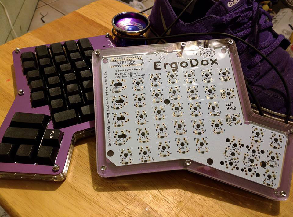 My complete Ergodox, showing off the underside of the case.