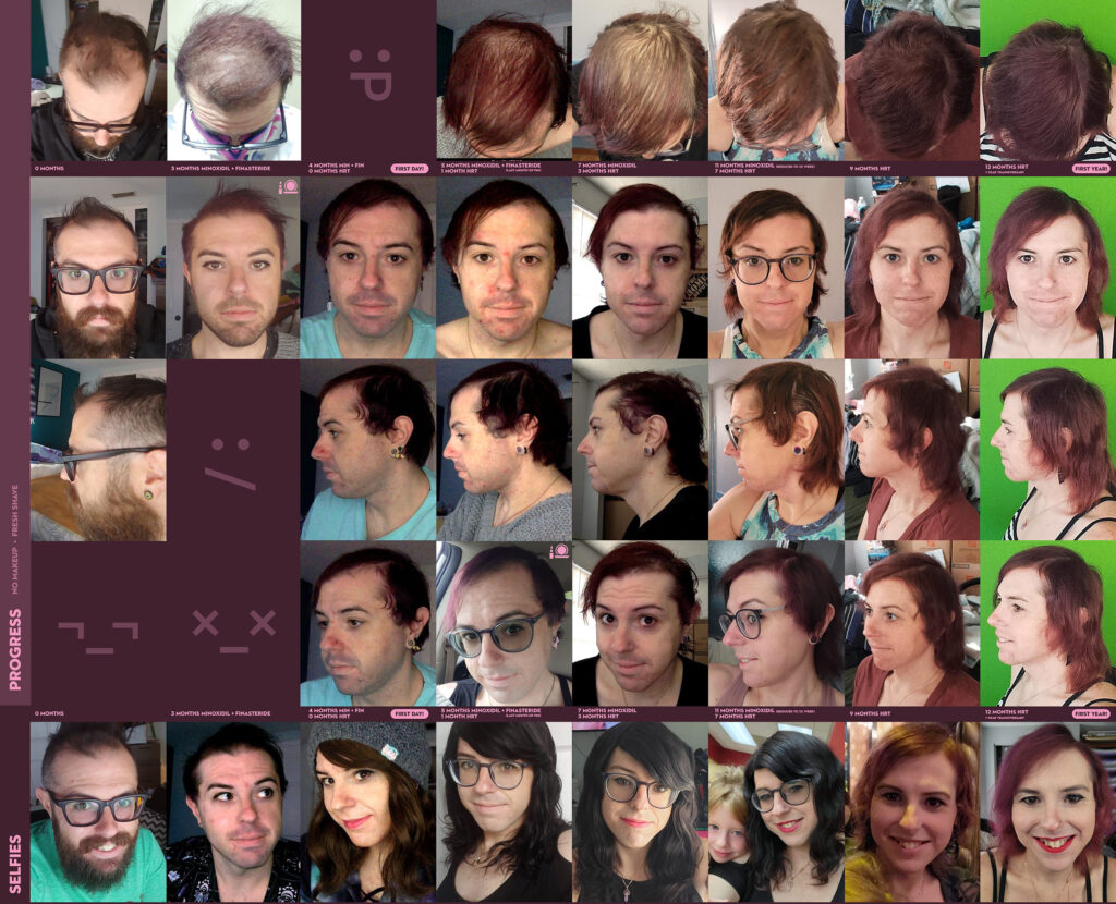 12mo timeline